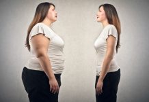 Chirurgia bariatrica vs. Obezitate