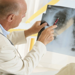 Tuberculoza se vindeca daca e tratata la timp