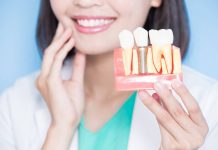 Riscuri ale unui implant dentar pe care trebuie sa le cunosti